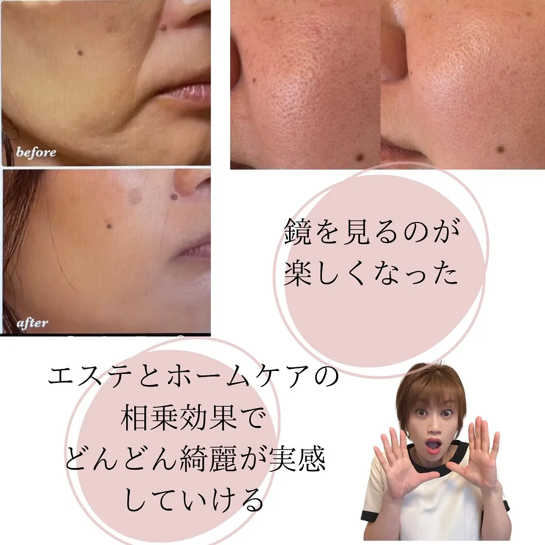 みんな知らないお肌の階段！