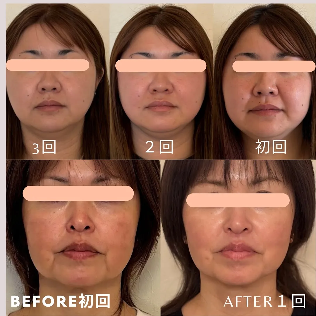 お客様の9割以上が効果を実感！