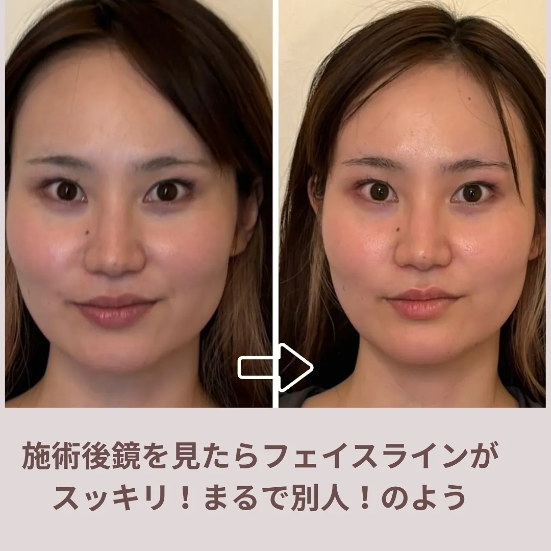 顔大きくなってきたかな！