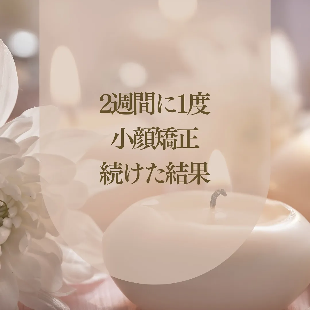 ほうれい線がどこかへ消えた！