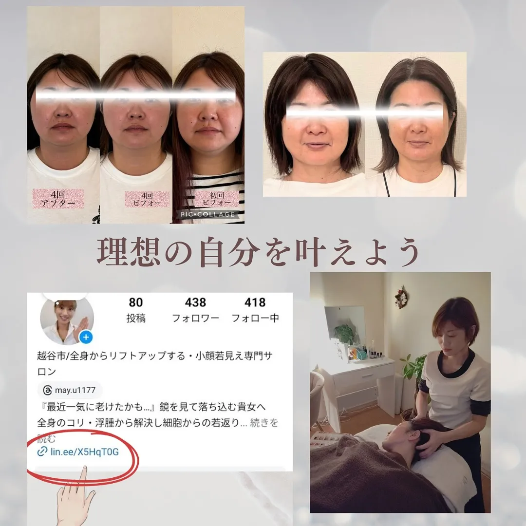 ほうれい線がどこかへ消えた！