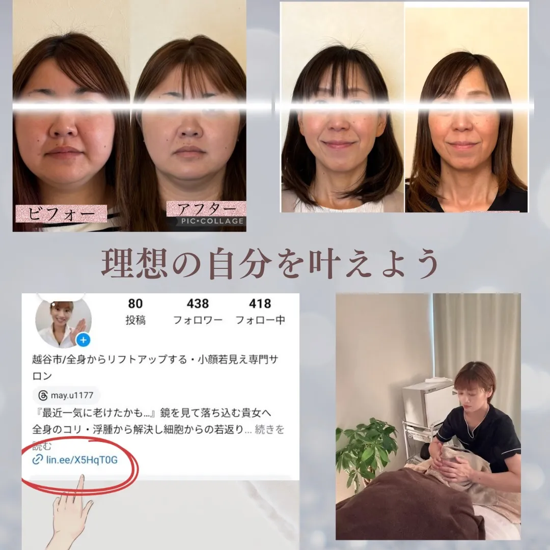 たるみの原因は？