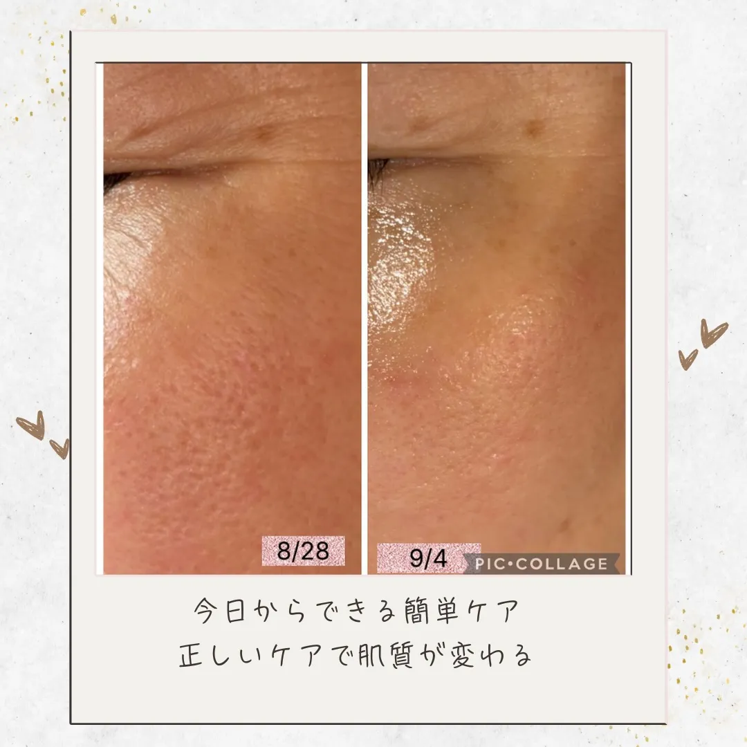 お肌くすみ、毛穴汚れ原因は？